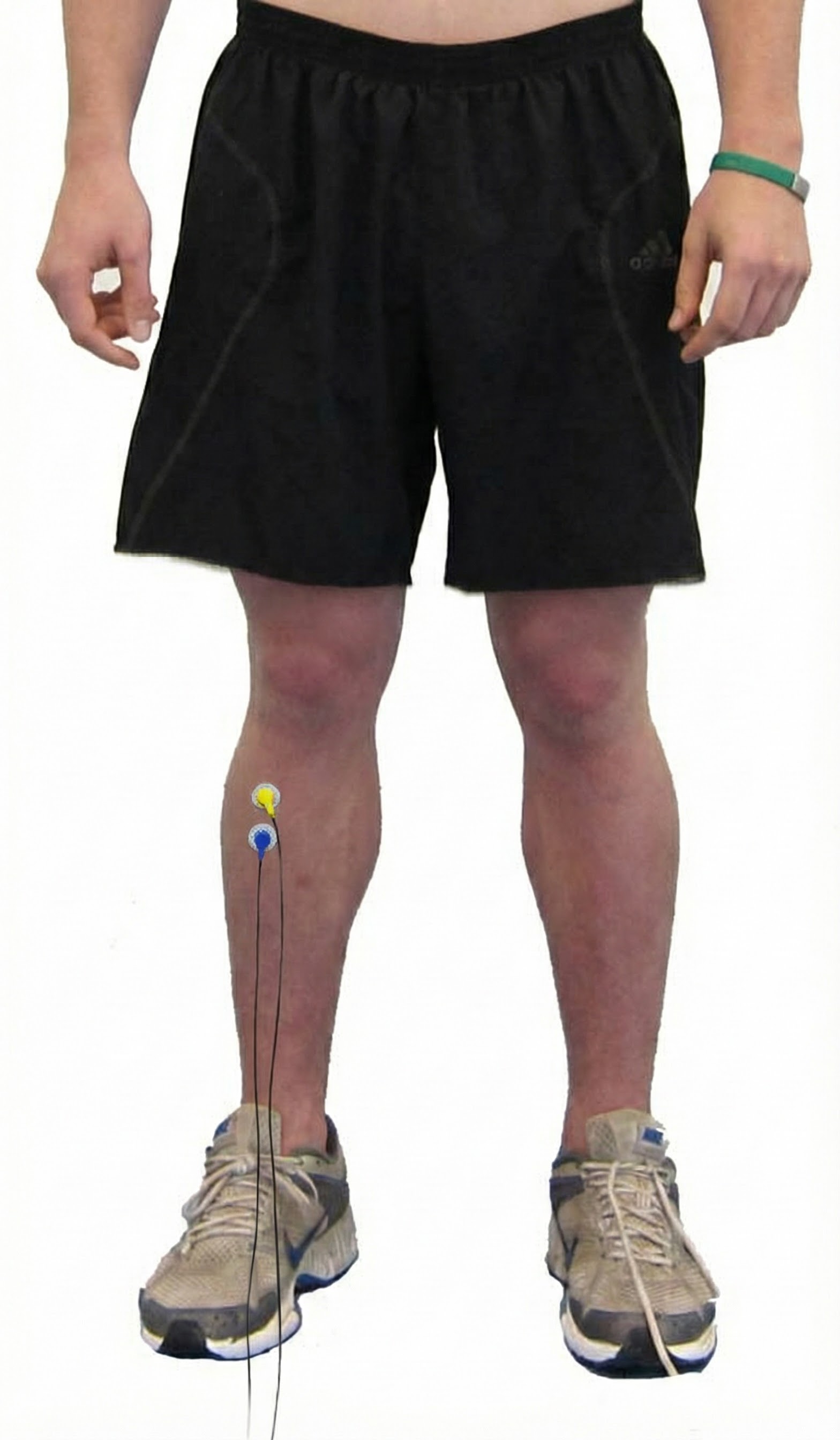Tibialis anterior sensor placement